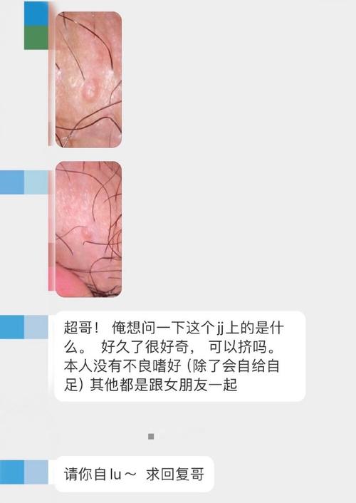 男孩去水上乐园玩水感染传染性软疣