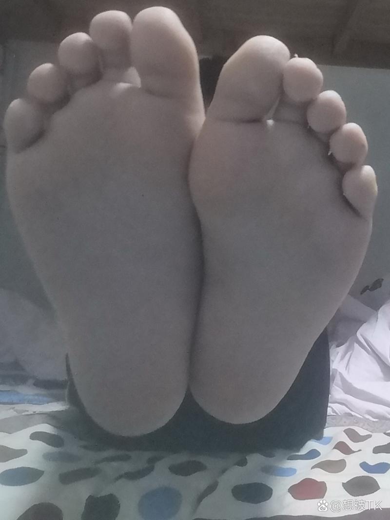 挠体育生脚心,设计策略快速解答_整版DKJ656.74